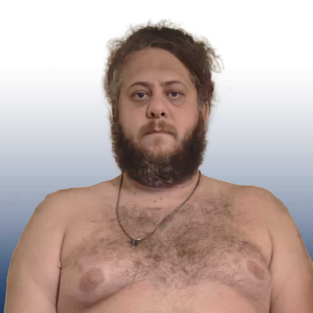 Sumo wrestler with beard and chest hair, looking serious.
