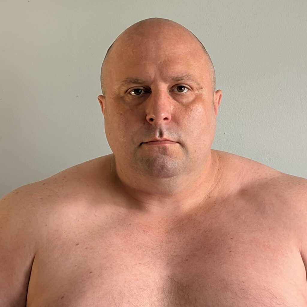 Bald man with serious expression facing camera.